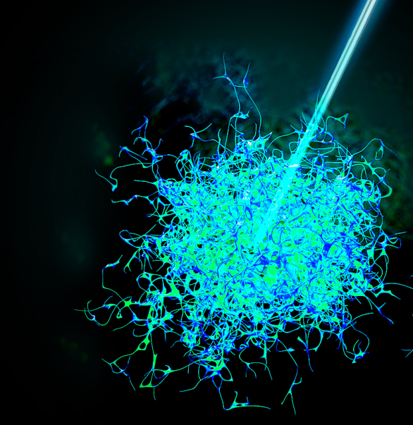 今天，我們把腫瘤的內(nèi)部「融穿」了
