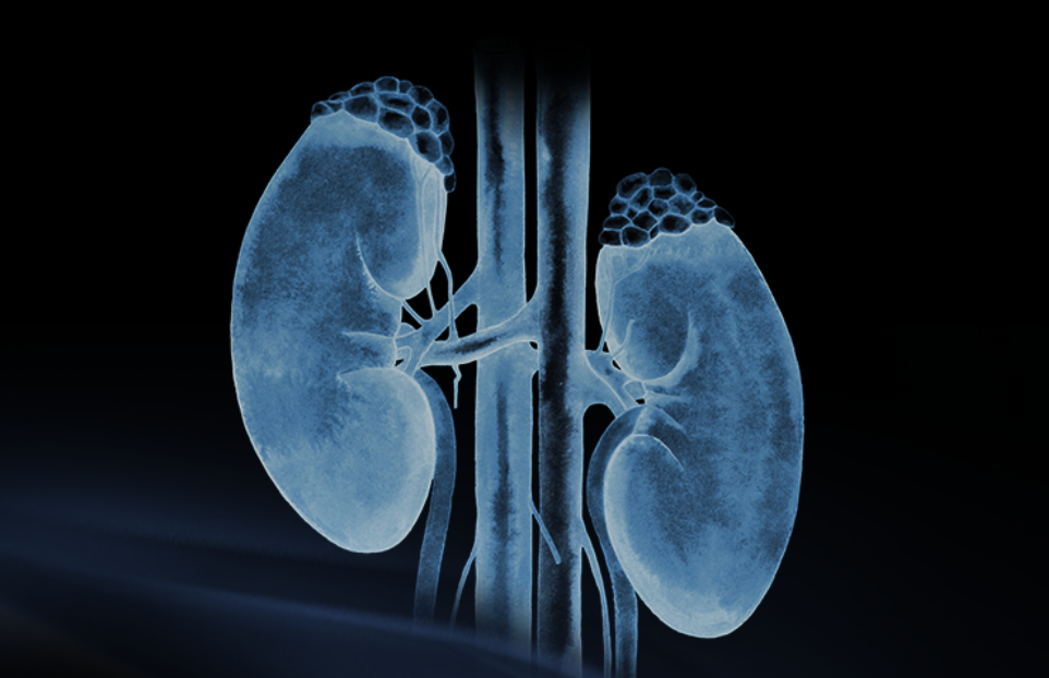 世界腎臟日 | 相得「腎」歡，融有術(shù)、精準(zhǔn)適形